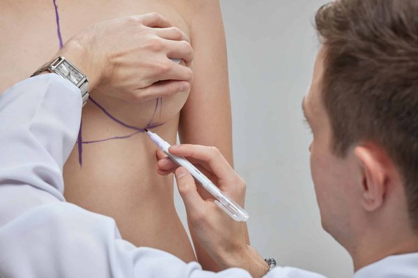 Chirurgie esthétique : tout savoir sur les implants mammaires